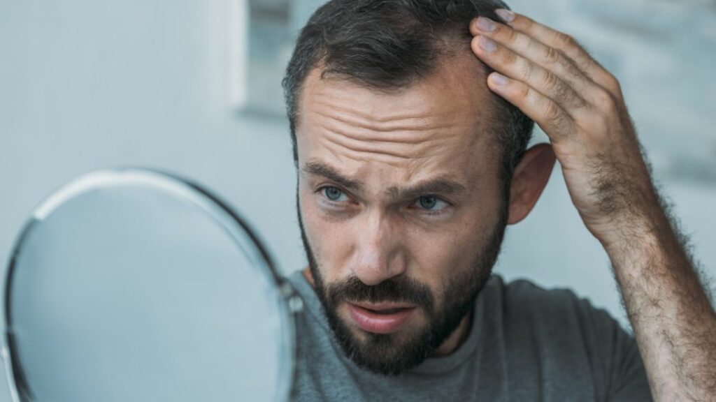 hair loss treatments